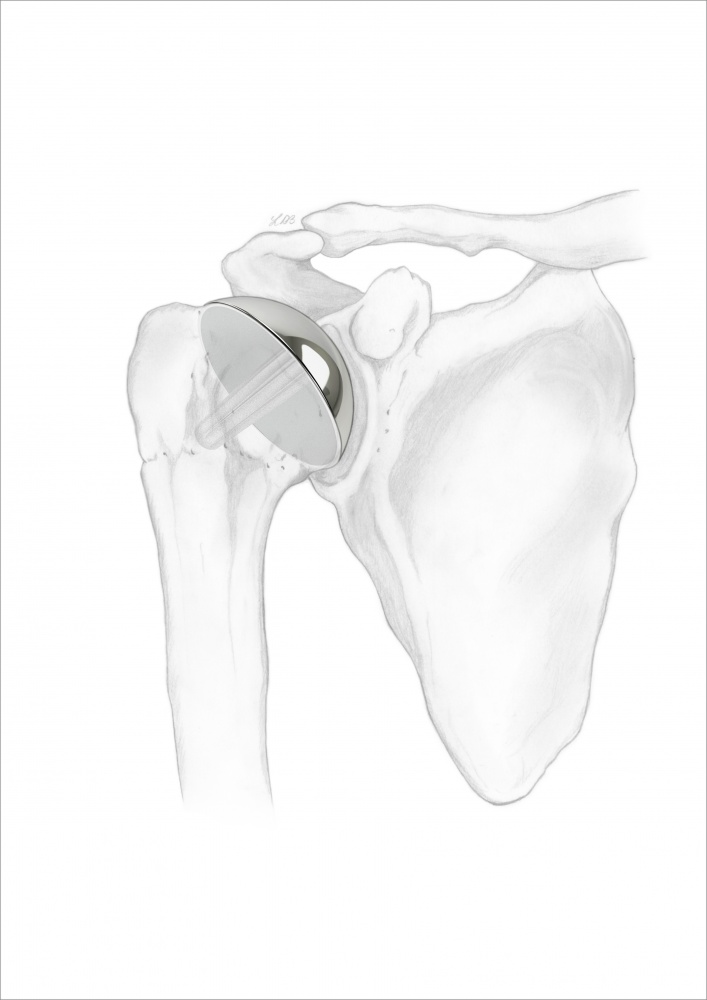 Image for 
